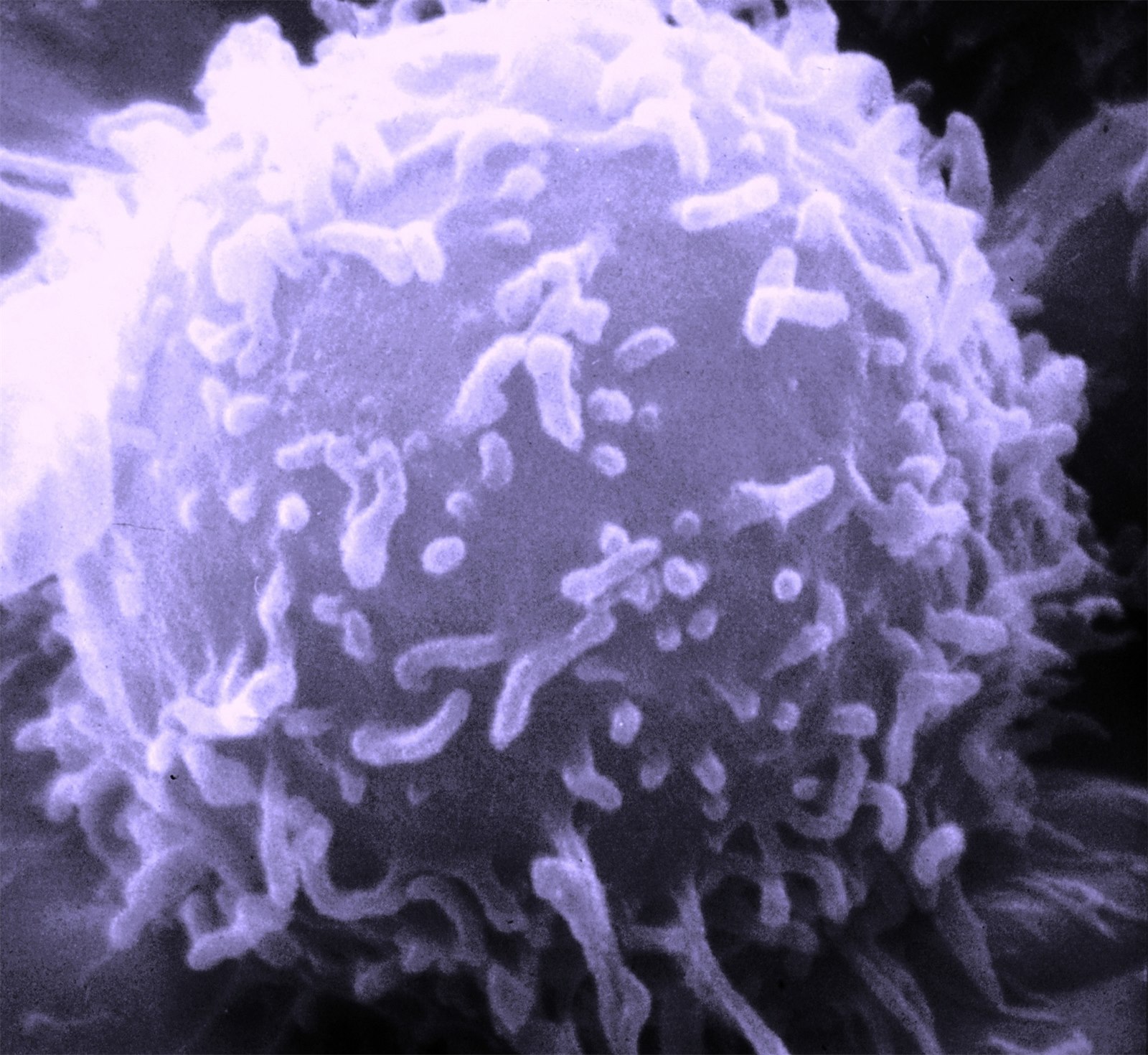 £50m Immunology Centre Pursues Cures, Not Lifelong Disease Management